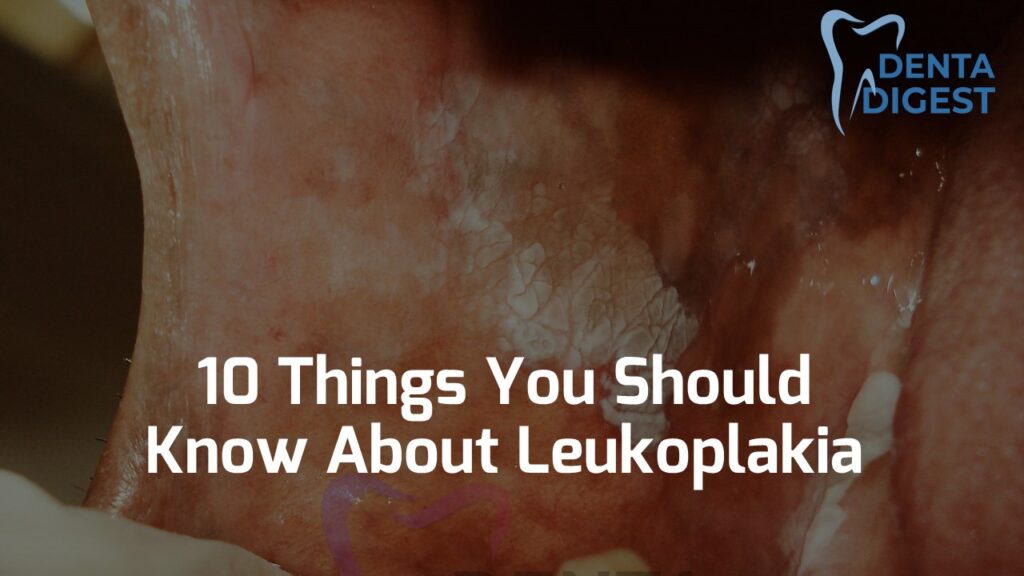 10 things you should know about leukoplakia