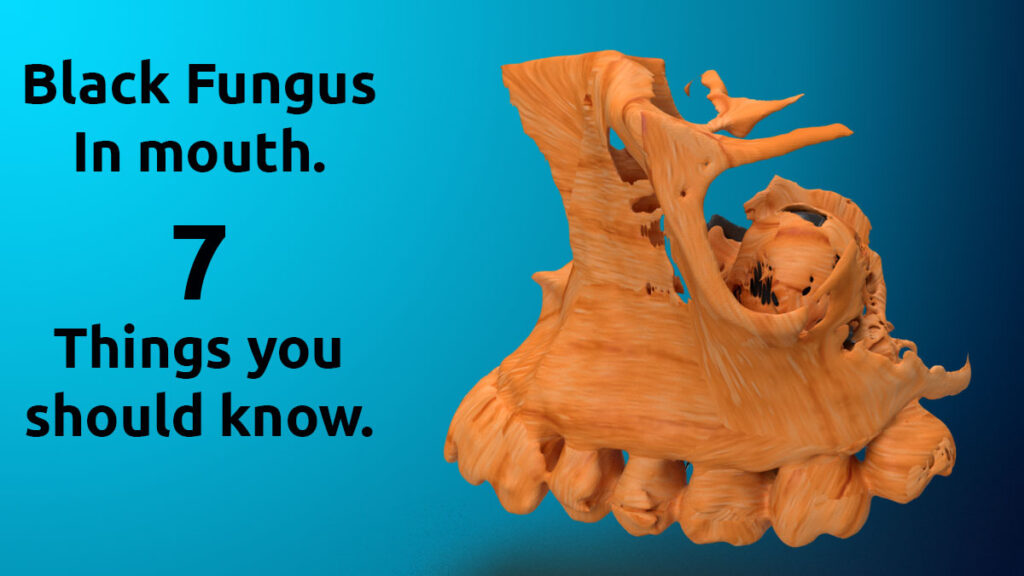 Black fungus in the mouth. Seven things to know