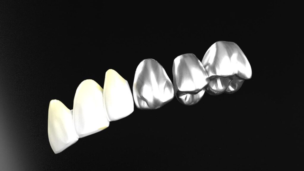 How to Choose the Best Dental Crown for Your Smile?