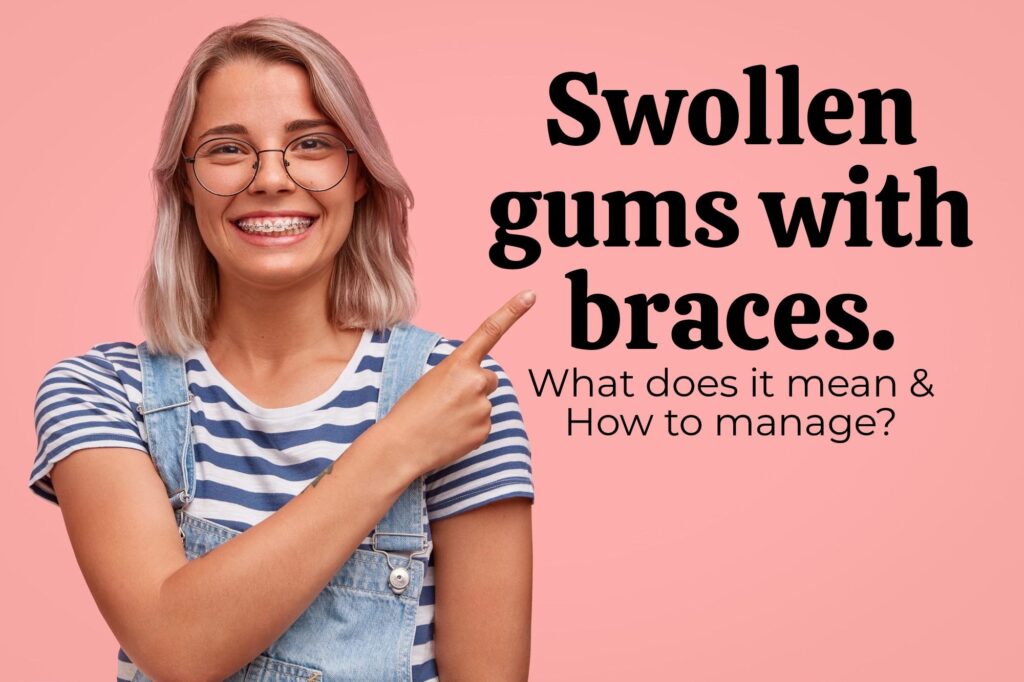 Swollen gums with braces. What does it mean?