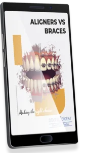 ALIGNERS VS BRACES